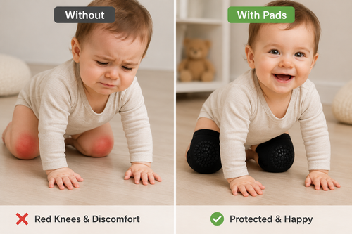 Baby Crawling Knee Pads Anti-Slip, Soft Cotton Elastic Knee Protectors for Infant Toddler Boys Girls 6-24 Months, 2 Pairs
